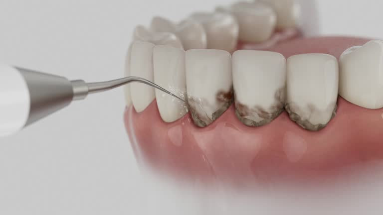Trusted Emergency Dentist service in Rolling Fork, MS - Dentist Open Now